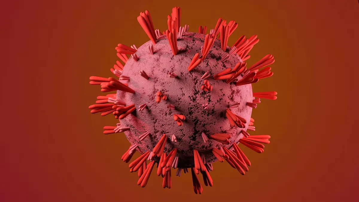 aplastic anemia